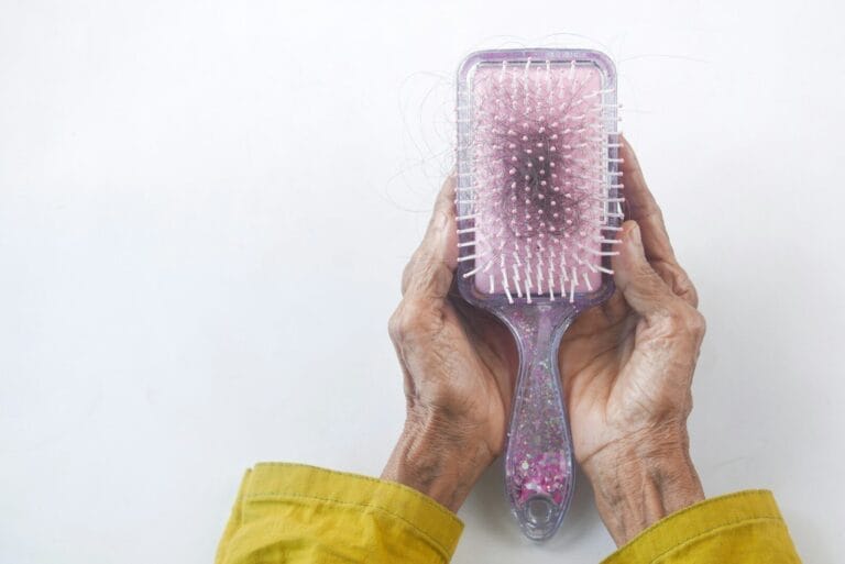 queda de cabelo